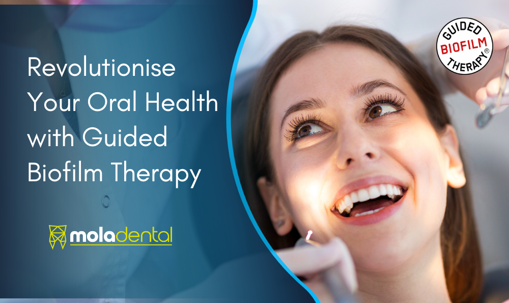 Revolutionise Your Oral Health with Guided Biofilm Therapy